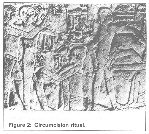 Circumcision ritual